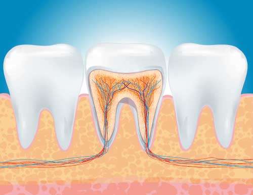 Endodoncia: ¿Qué es y cómo se hace? ¿Duele? ¿Cuanto tarda?